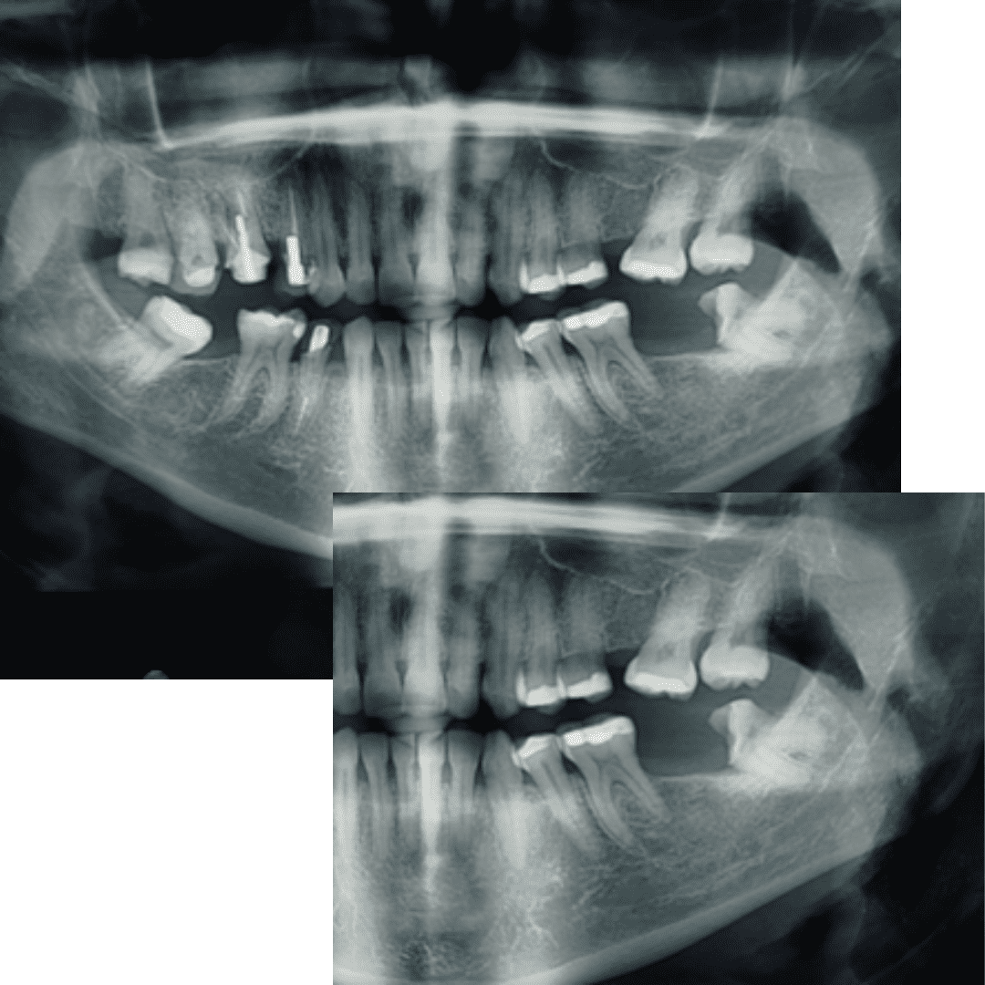 cirugia maxilofacial cuadrado